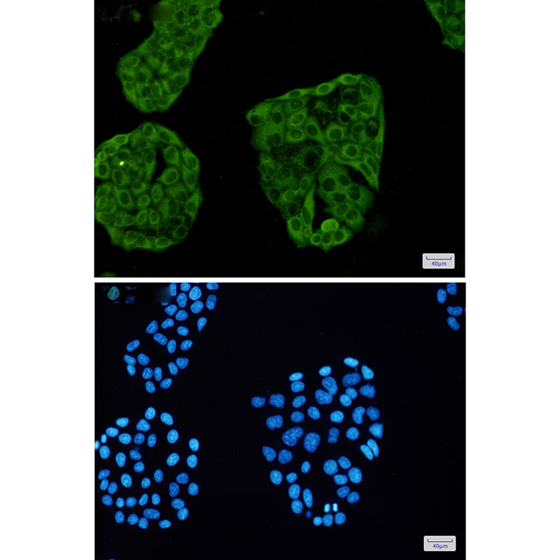[KD]Annexin VI Rabbit mAb ABZ4784