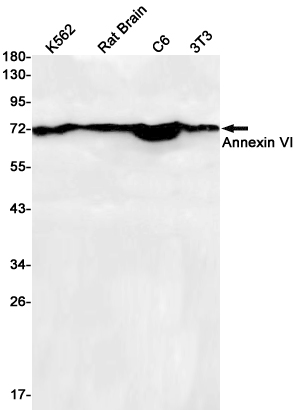 [KD]Annexin VI Rabbit mAb ABZ4784