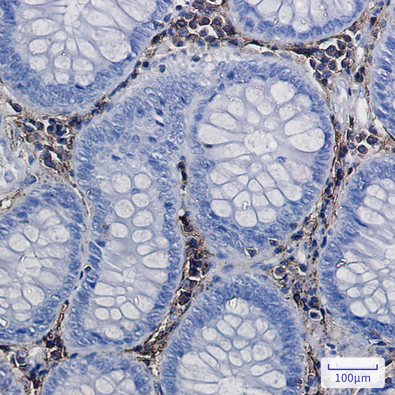 [KO]Annexin VI Rabbit mAb ABZ4785