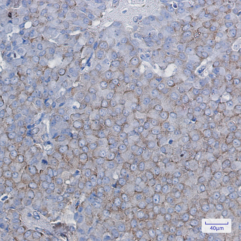 [KO]BTF3 Rabbit mAb ABZ4786