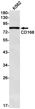 [KD]CD168 Rabbit mAb ABZ4787