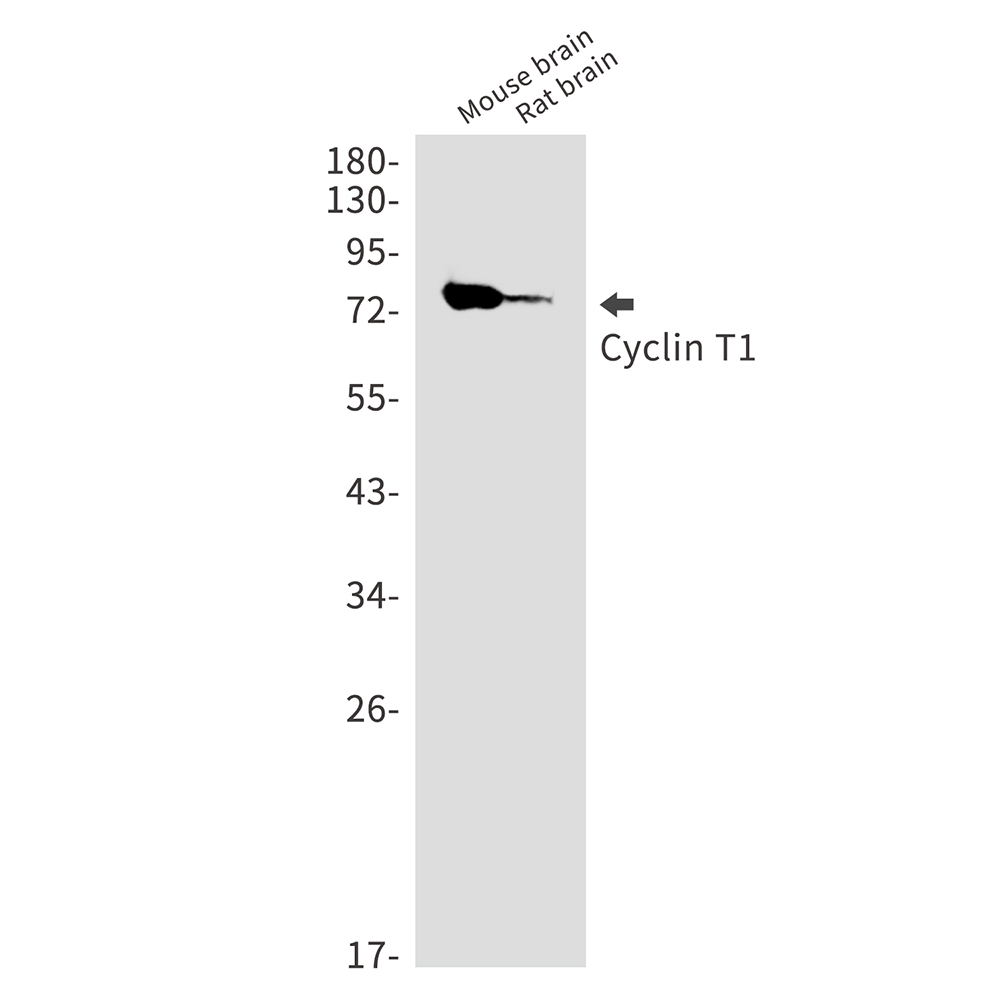 [KD]Cyclin T1 Rabbit mAb ABZ4790