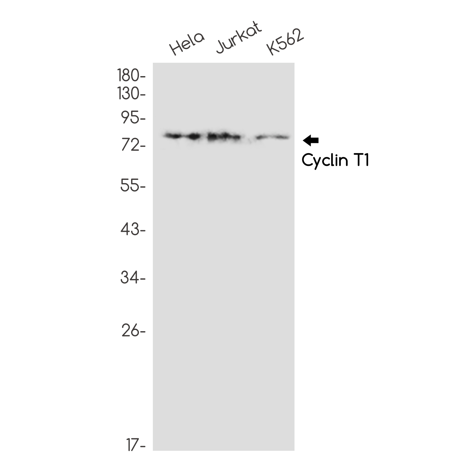 [KD]Cyclin T1 Rabbit mAb ABZ4790