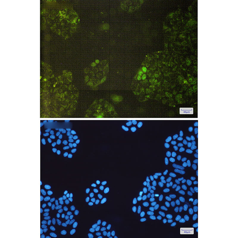 [KD]GSTK1 Rabbit mAb ABZ4793