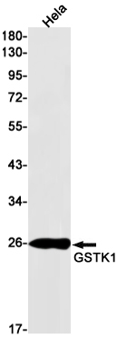 [KD]GSTK1 Rabbit mAb ABZ4793