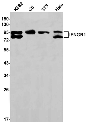 [KD]IFNGR1 Rabbit mAb ABZ4795