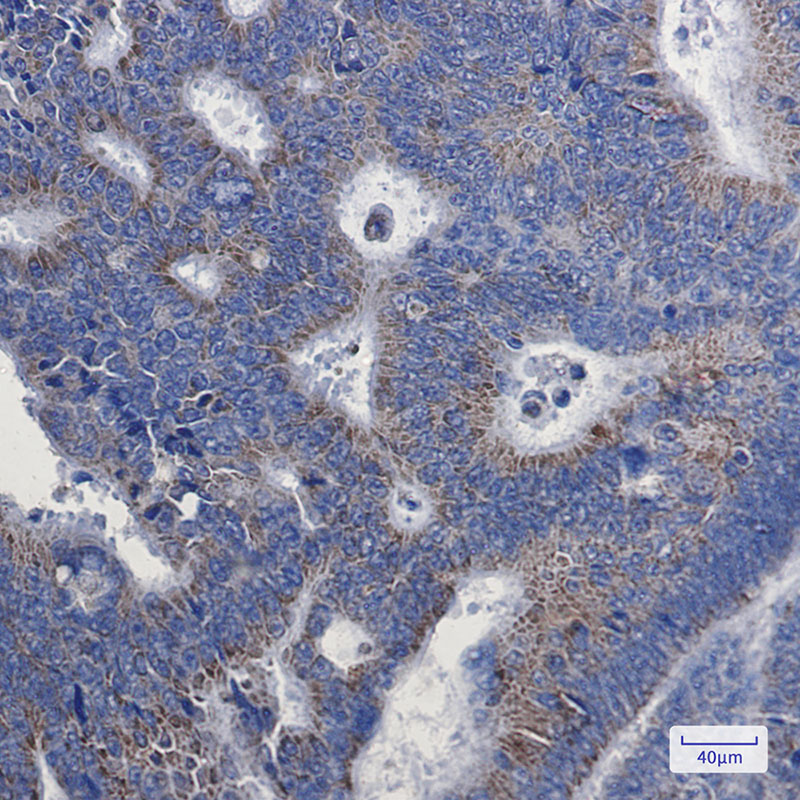 [KD]NDUFA1 Rabbit mAb ABZ4796