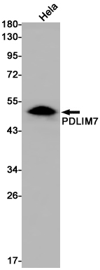 [KD]PDLIM7 Rabbit mAb ABZ4797