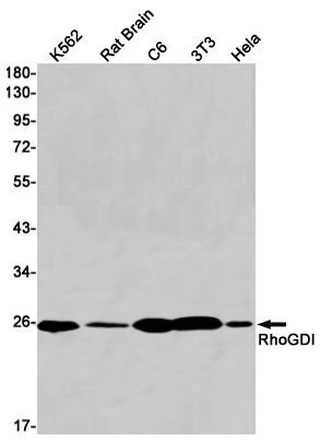 [KO]RhoGDI Rabbit mAb ABZ4798