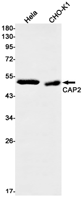 [KD]CAP2 Rabbit mAb ABZ4800