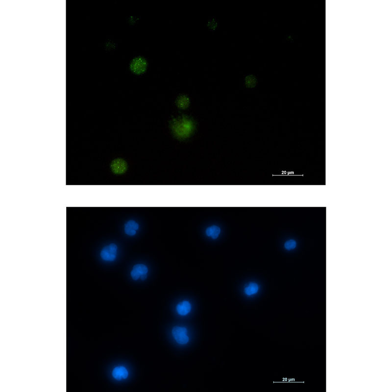 [KO]E1B AP5 Rabbit mAb ABZ4801