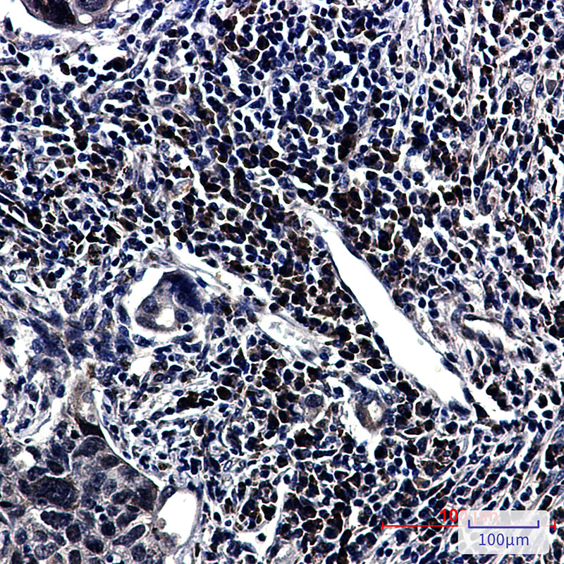 [KO]E1B AP5 Rabbit mAb ABZ4801