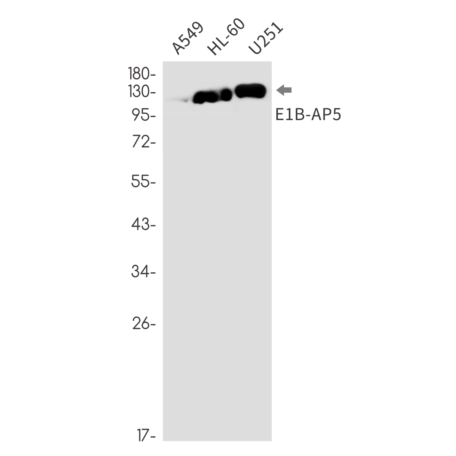 [KO]E1B AP5 Rabbit mAb ABZ4801
