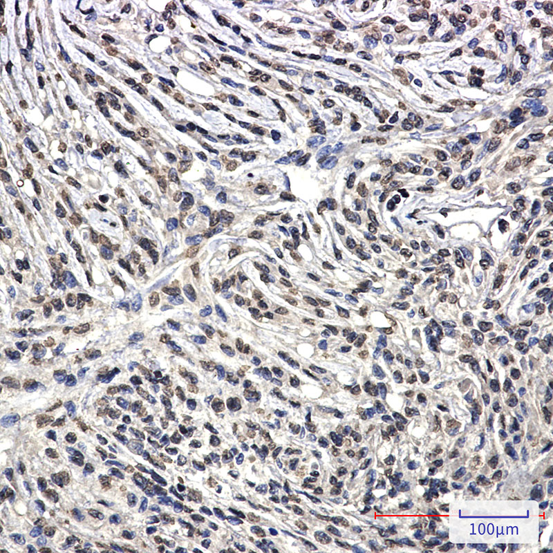 [KO]Bcr Rabbit mAb ABZ4802