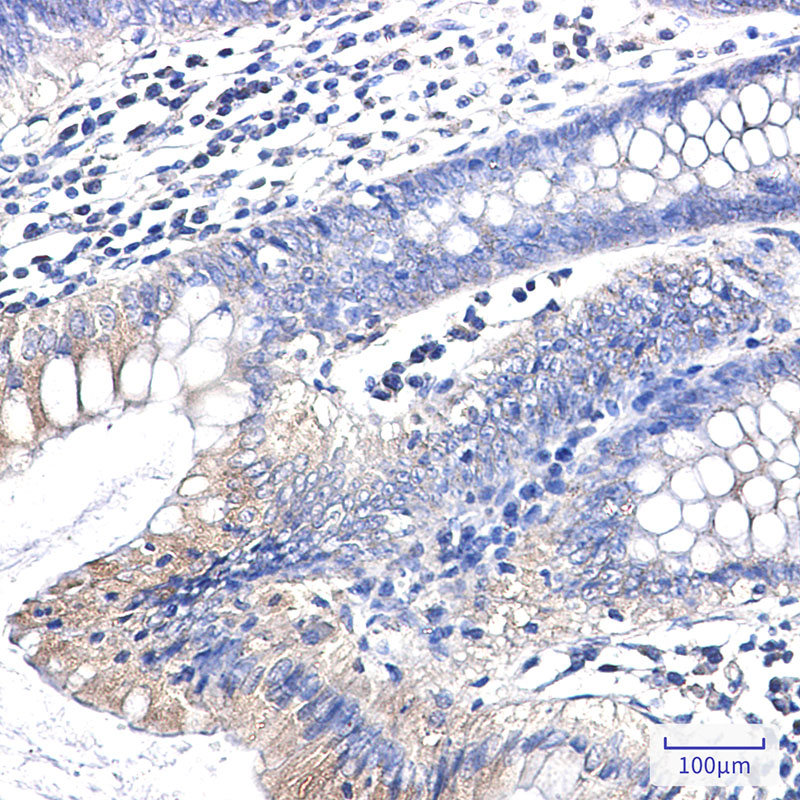 [KO]Clathrin Heavy Chain Rabbit mAb ABZ4803