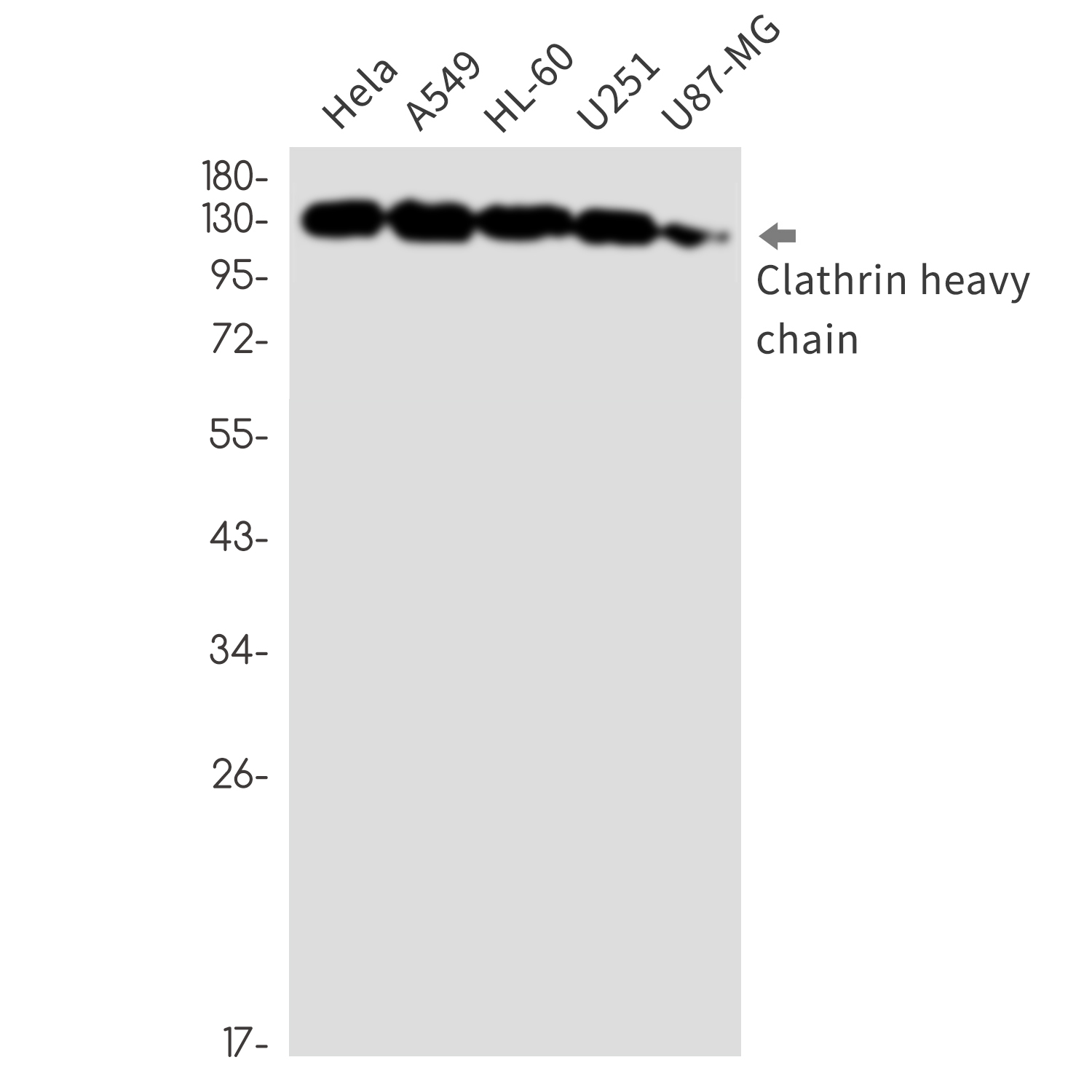 [KO]Clathrin Heavy Chain Rabbit mAb ABZ4803