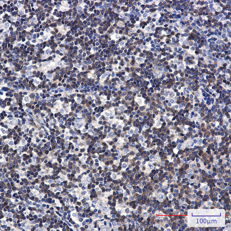 [KD]DGKA Rabbit mAb ABZ4804