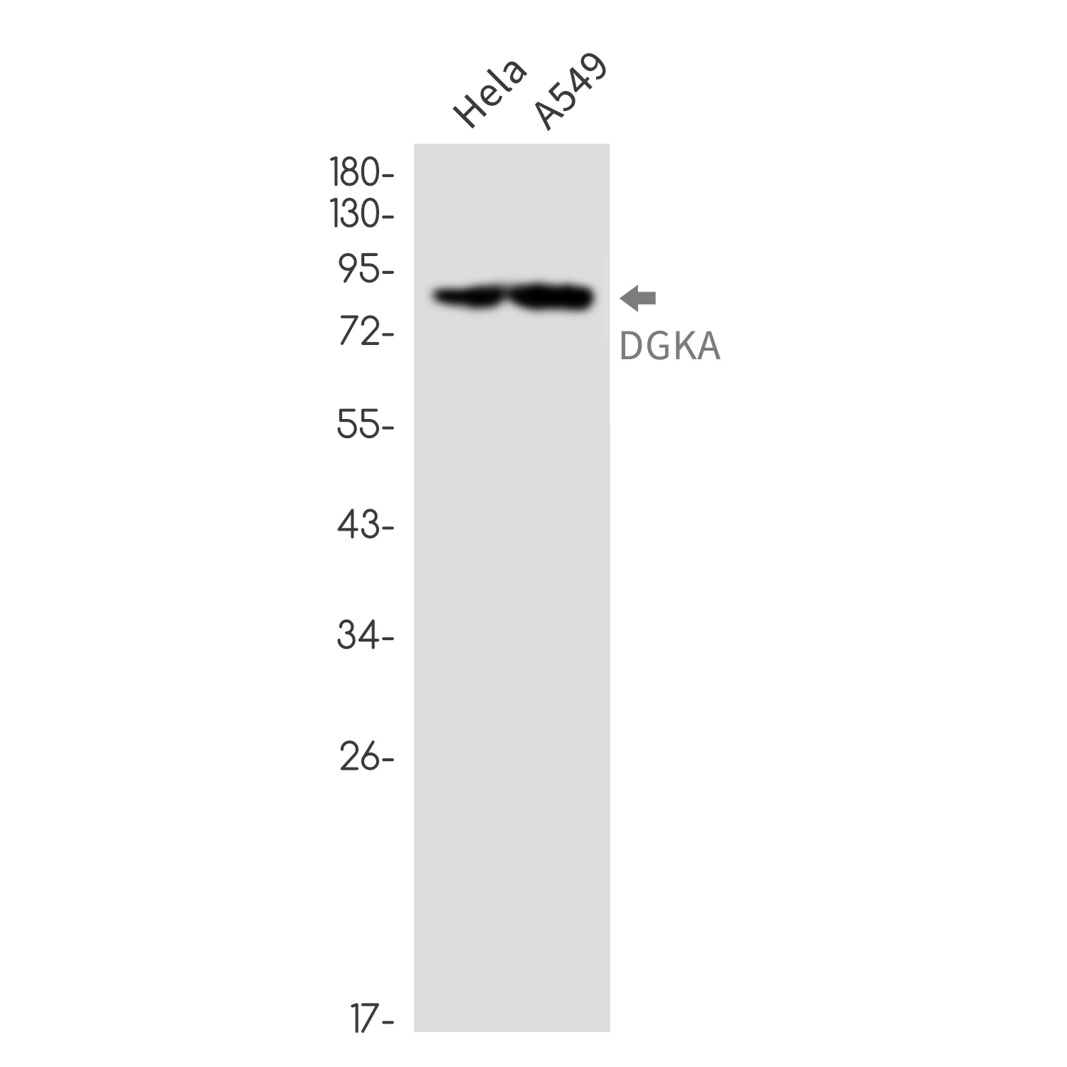 [KD]DGKA Rabbit mAb ABZ4804