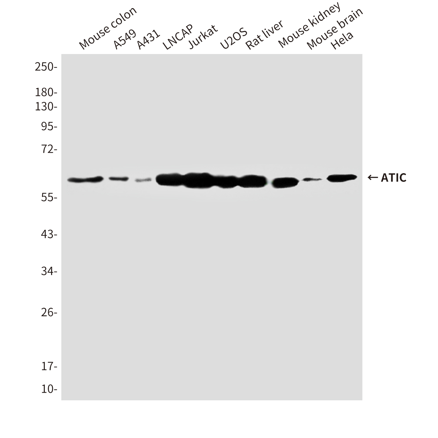 [KO]ATIC (3H12) Mouse mAb ABZ4807