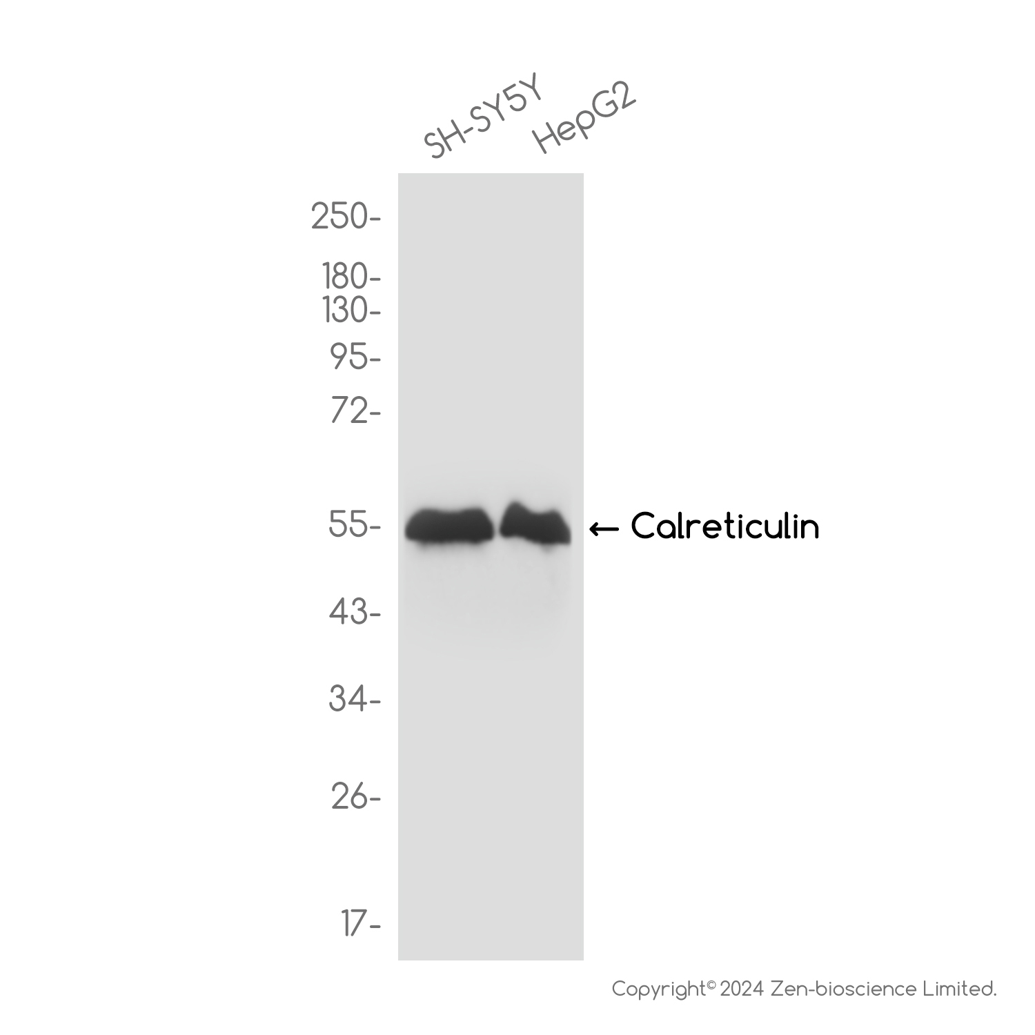 [KO]Calreticulin Rabbit mAb ABZ4817