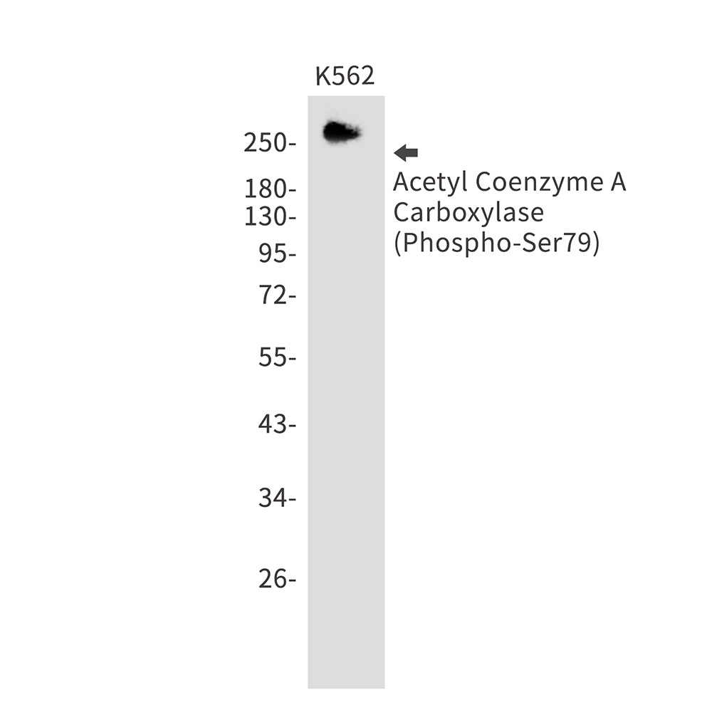 [KD]Phospho-ACC1 (Ser79) Rabbit mAb ABZ4818