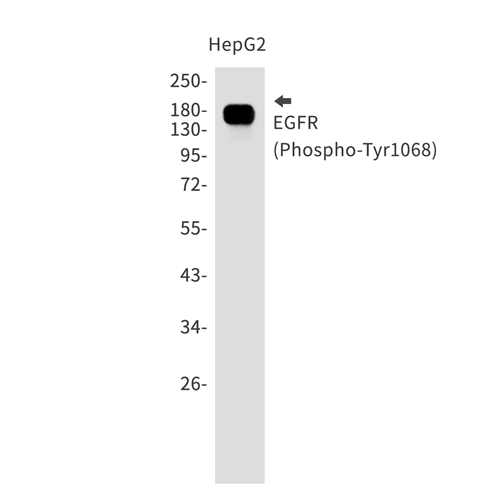 [KO]Phospho-EGFR (Tyr1068) Rabbit mAb ABZ4819