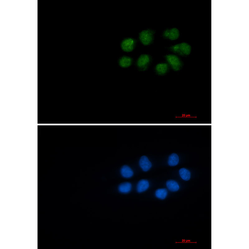 [KD]Phospho-Vimentin (Ser56) Rabbit mAb ABZ4820