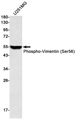 [KD]Phospho-Vimentin (Ser56) Rabbit mAb ABZ4820