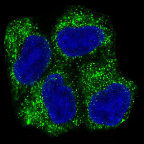 [KD]AMPK alpha 1 Rabbit mAb ABZ4821