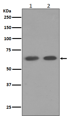 [KD]AMPK alpha 1 Rabbit mAb ABZ4821