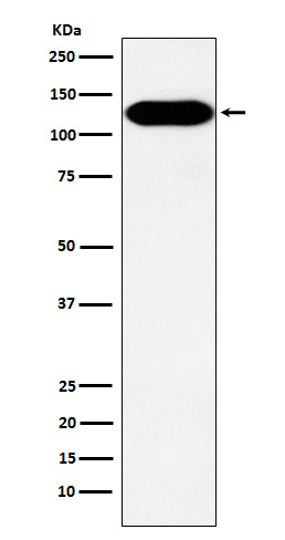 [KD]BCAR1 Rabbit mAb ABZ4822