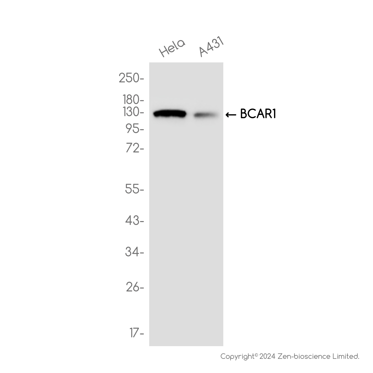 [KD]BCAR1 Rabbit mAb ABZ4822