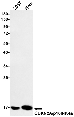 [KD]CDKN2A/p16INK4a Rabbit mAb ABZ4824