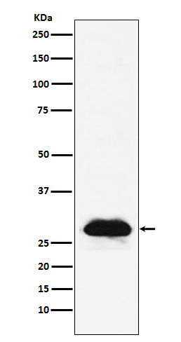 [KD]Carbonic Anhydrase 2 Rabbit mAb ABZ4825