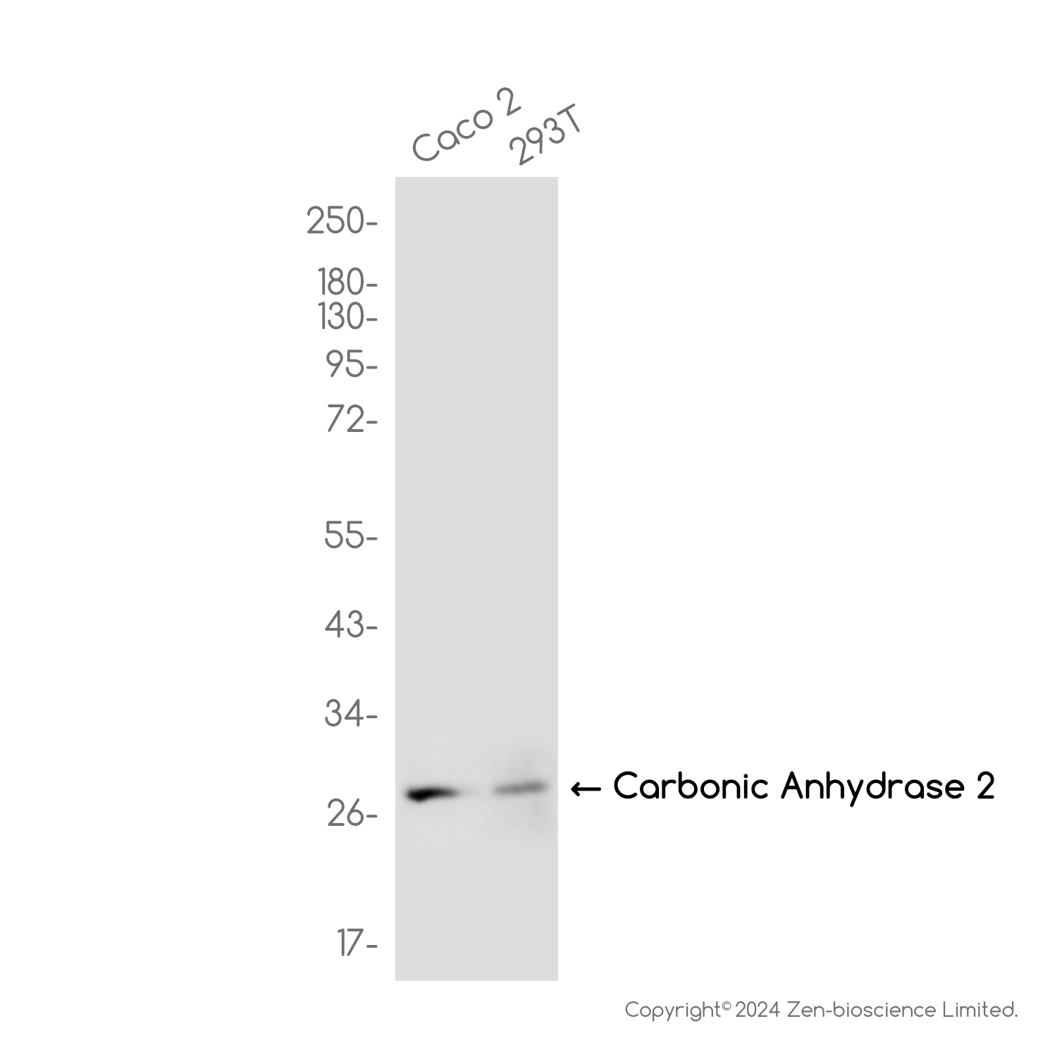 [KD]Carbonic Anhydrase 2 Rabbit mAb ABZ4825