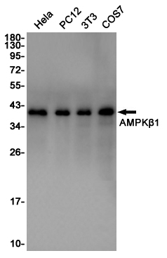 AMPK beta 1 Rabbit mAb ABZ4827