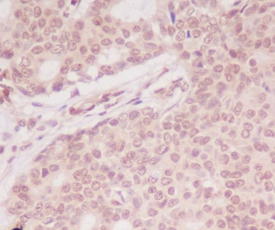 ATF5 Rabbit mAb ABZ4829