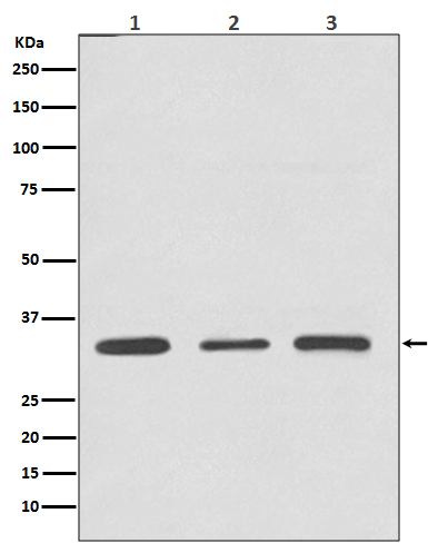 ATF5 Rabbit mAb ABZ4829