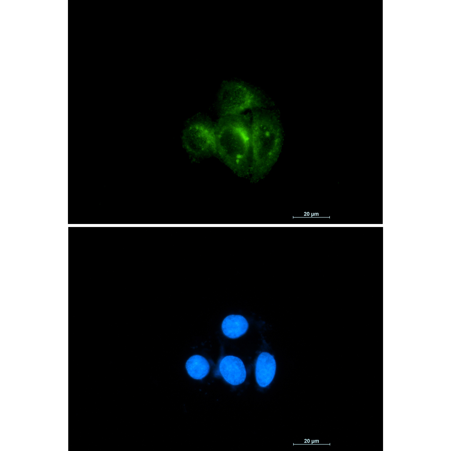AKT Rabbit mAb ABZ4830