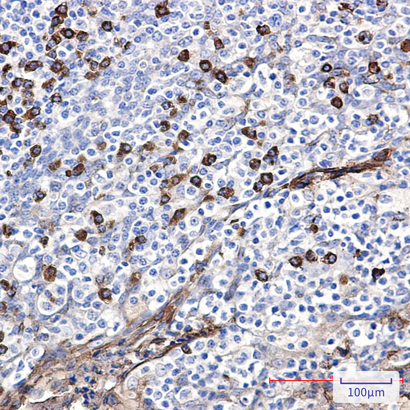 AKT Rabbit mAb ABZ4830