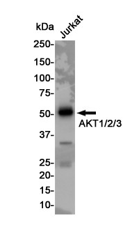 AKT Rabbit mAb ABZ4830