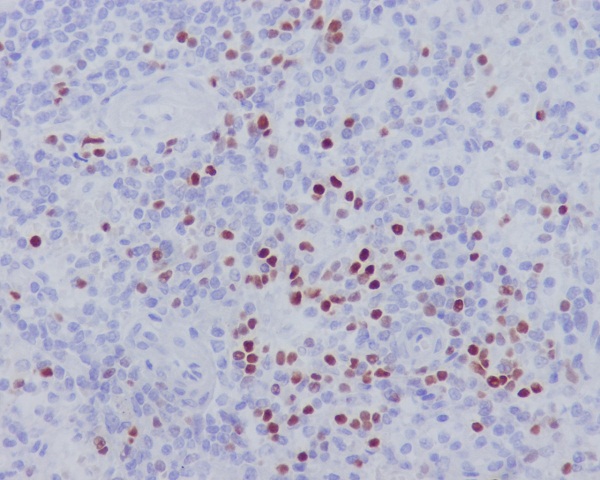 LEF1 Rabbit mAb ABZ4831