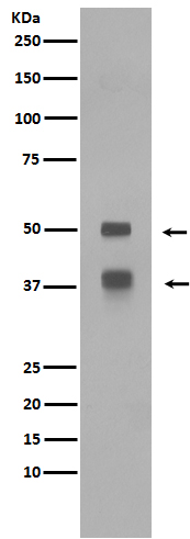 LEF1 Rabbit mAb ABZ4831