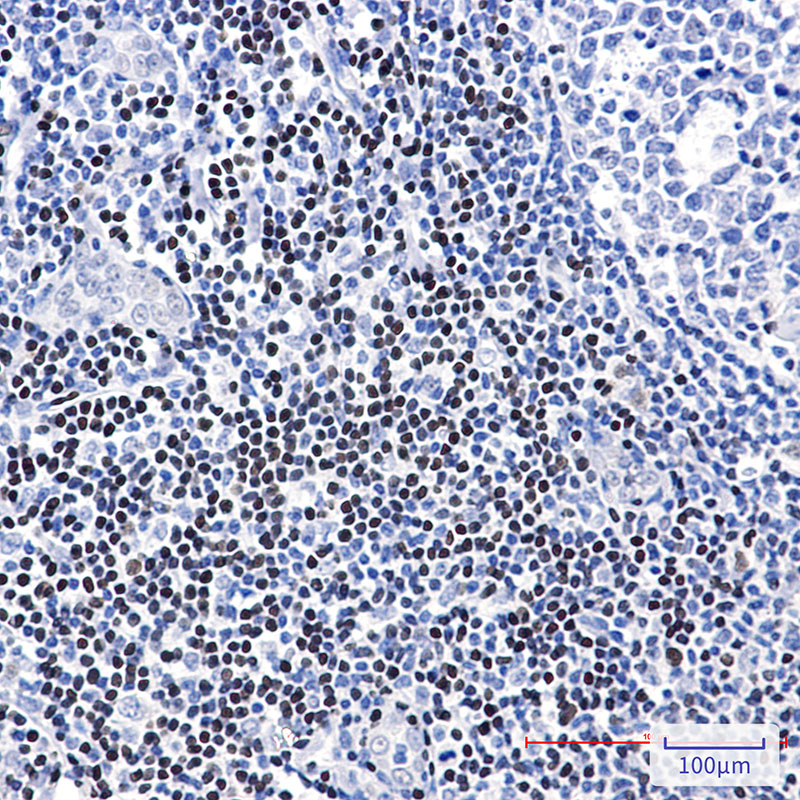 LEF1 Rabbit mAb ABZ4832