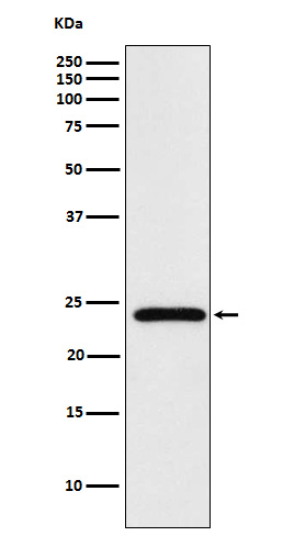 MAD2L2 Rabbit mAb ABZ4833