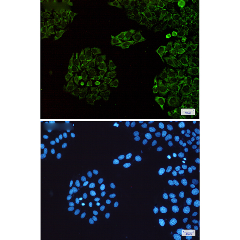 SENP1 Rabbit mAb ABZ4835