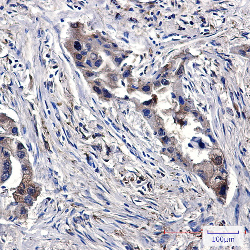 SENP1 Rabbit mAb ABZ4835