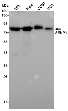 SENP1 Rabbit mAb ABZ4835