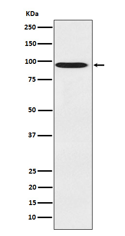 CDT2 Rabbit mAb ABZ4836