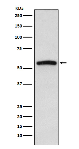 IRAK4 Rabbit mAb ABZ4837